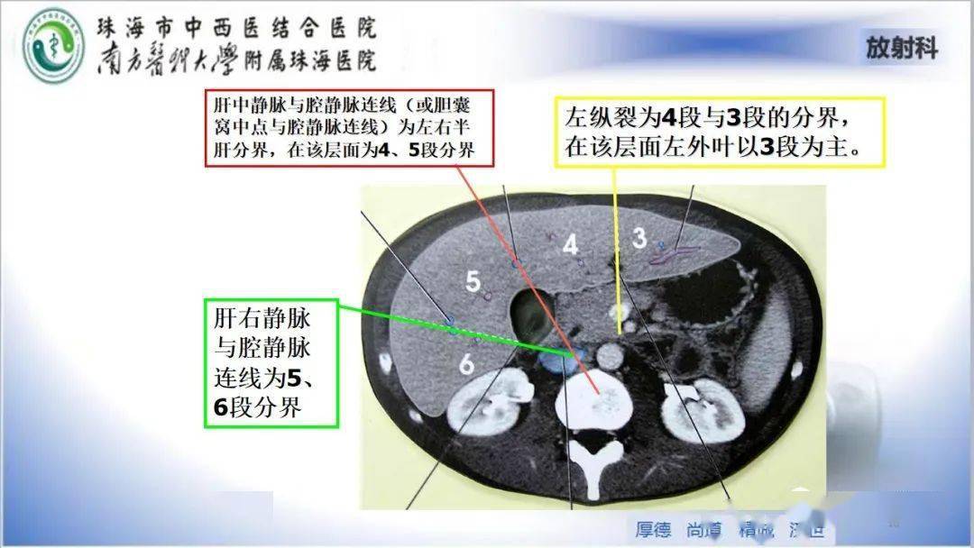 肝脏影像分段及肝硬化结节mri诊断_文章