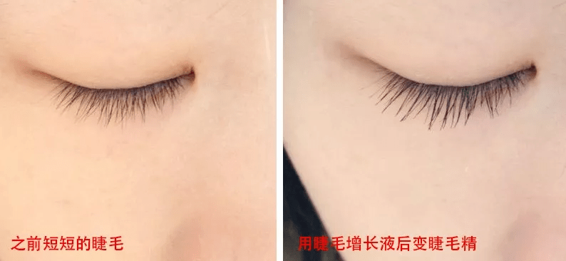 眉毛怎么变得浓密 cdbc6581828845ddbeb5565089842dc9.png