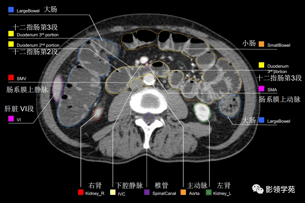 腹部影像学解剖图谱拿走不谢