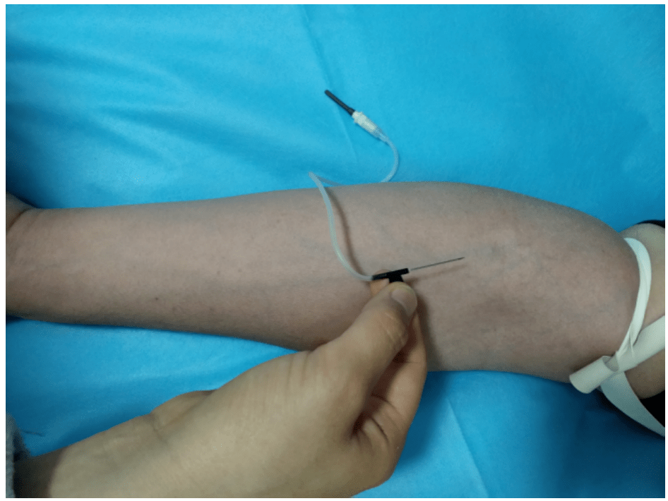 血培养采集你可能真的做错了