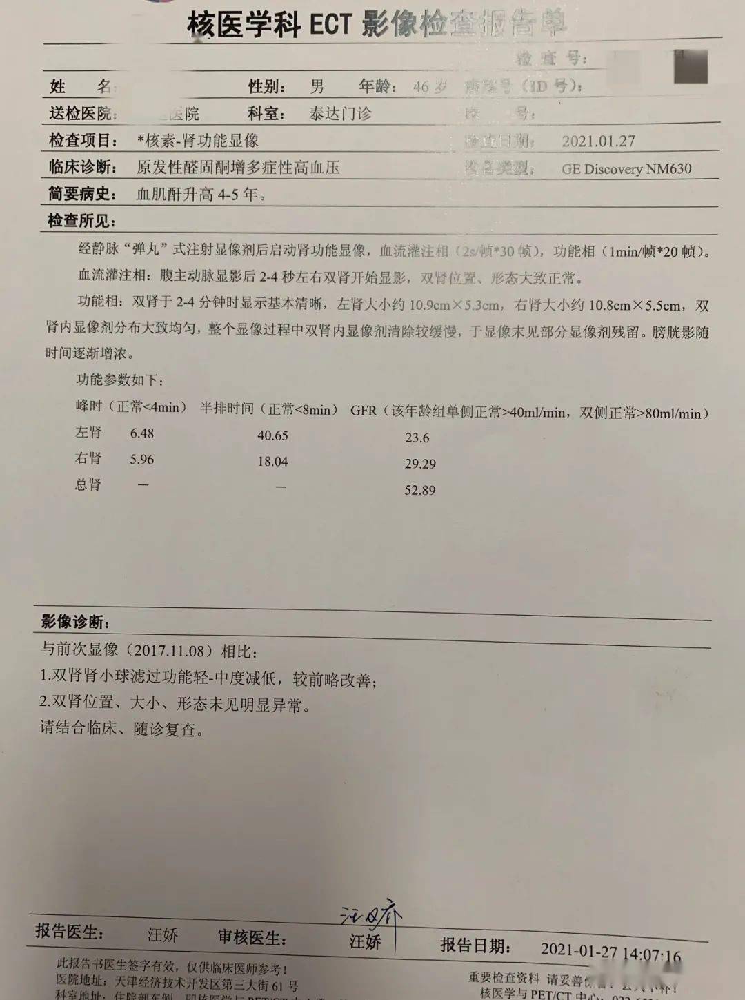 前两天复诊,又复查了ect,复查结果竟然出乎我的预料,肾小球滤过率为