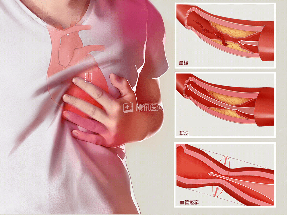 心率加快,心肌耗氧量增加,再加上寒冷刺激会加重心脏血管痉挛,冠脉