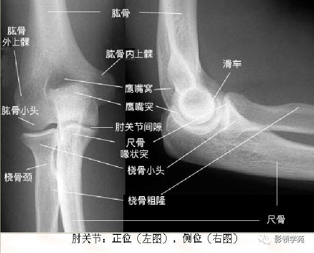 桡骨与尺骨借桡尺近侧关节,桡尺远侧关节和前臂骨间膜相连结