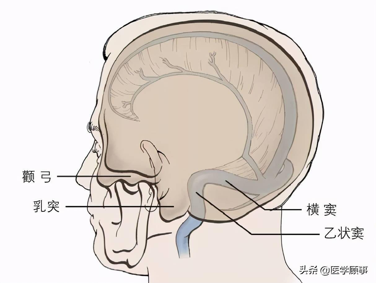 大脑矢状窦解剖图图片