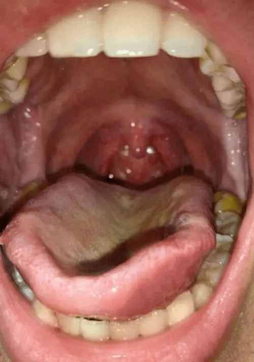 这种奇果冬天才能吃到清肺化痰百病消吃一口惦记一年