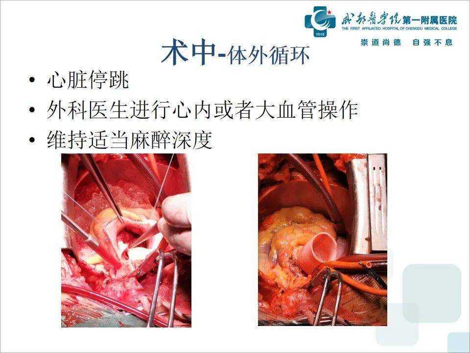 常规体外循环心脏手术步骤与麻醉