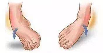 崴脚了怎么办 一分钟快速解决 损伤