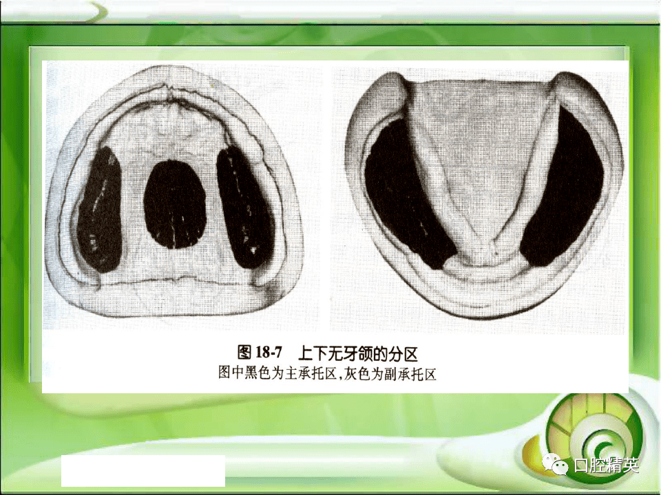 下颌无牙颌解剖标志图图片