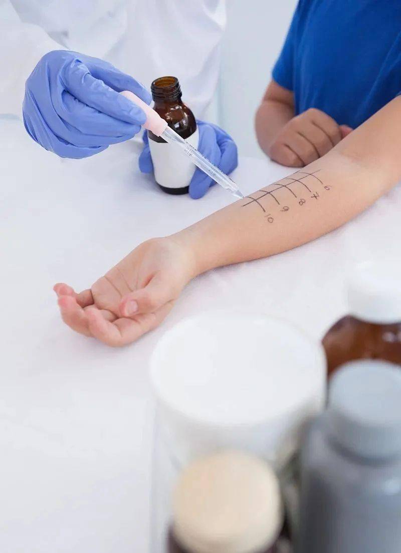 为什么要做过敏原检测如何在新年中减少患过敏几率