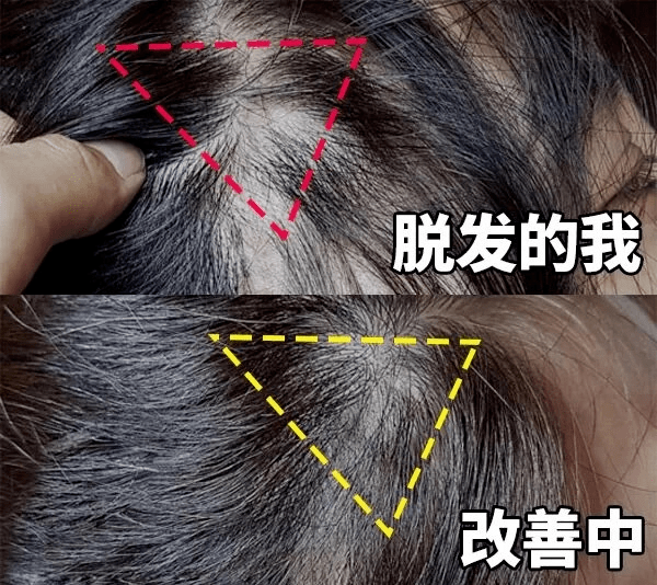 dd812e092f604bf489195ba2504887b4.png