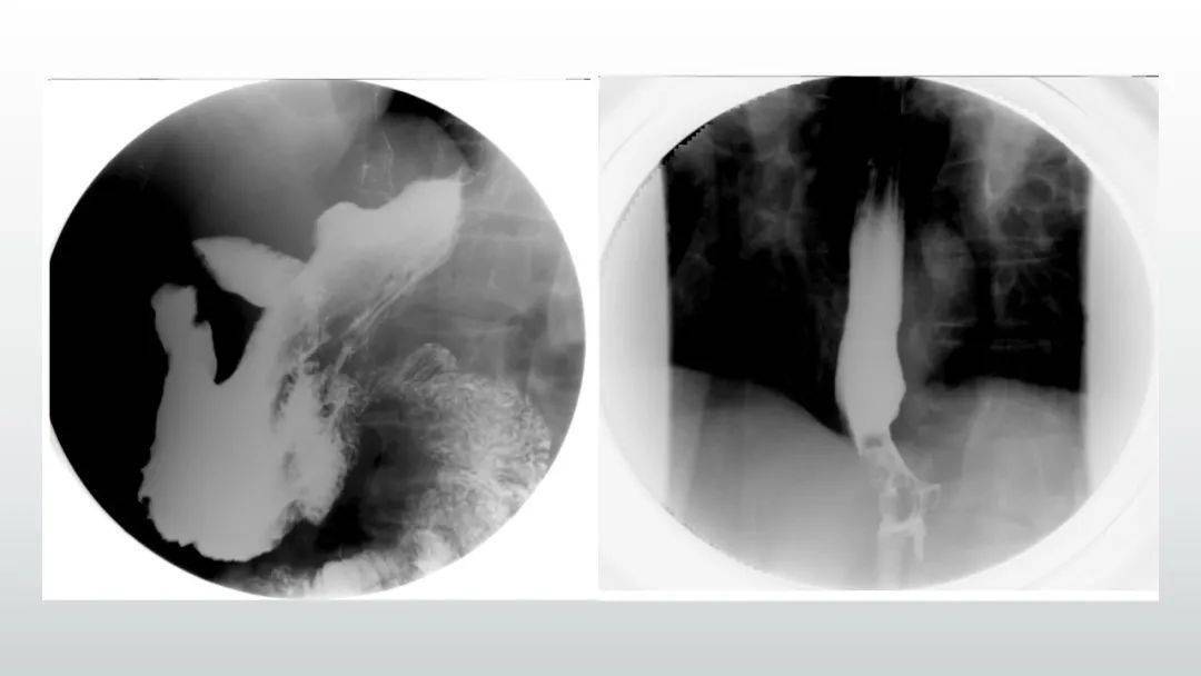 什么是神经内分泌细胞 275108b468614920ac5275a513ee4c48.jpeg
