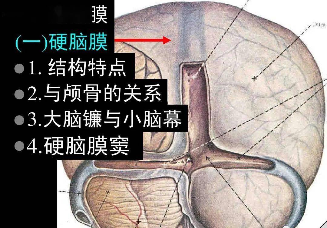 高清解剖脑室脑池脑膜