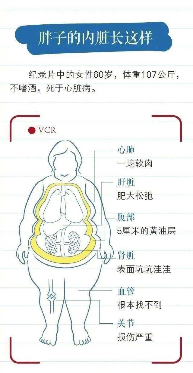 肥胖人口数量增多_目前肥胖人口现状统计(3)