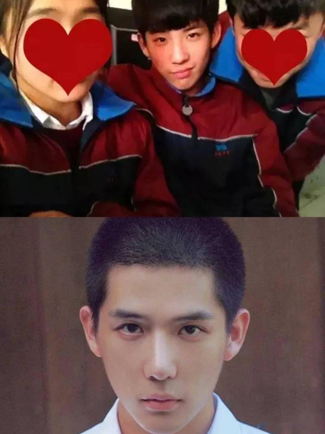 王安宇现身整形医院粉丝解释皮肤管理网友劝他整牙