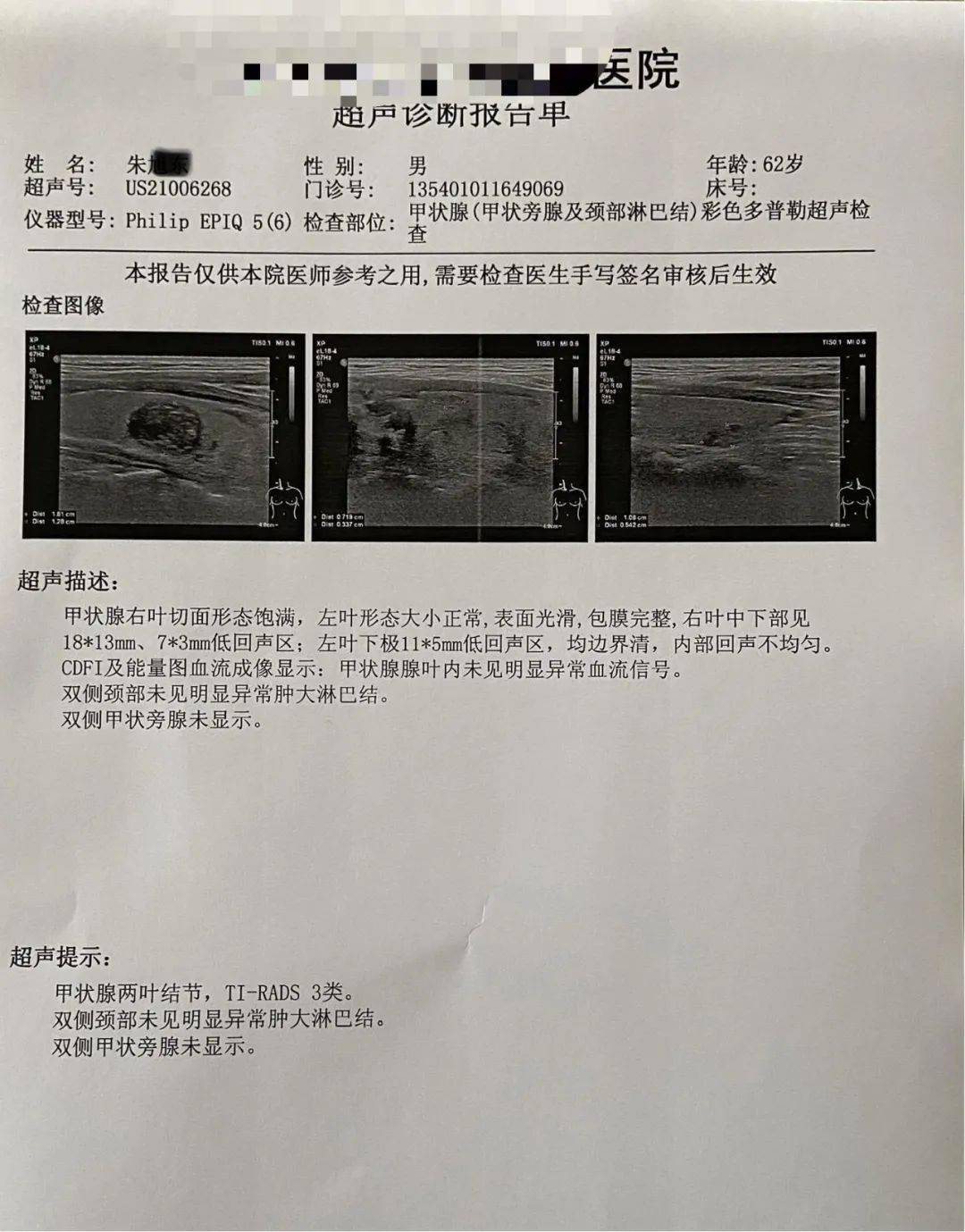 市中醫科普甲狀腺結節中醫有辦法