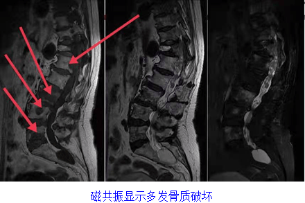 女性做磁共振要脱内衣(2)