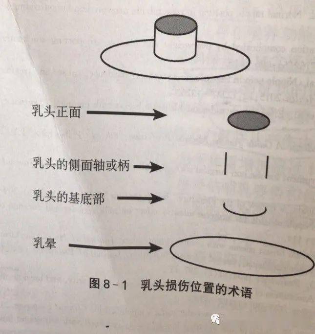 乳頭破了我要做什麼