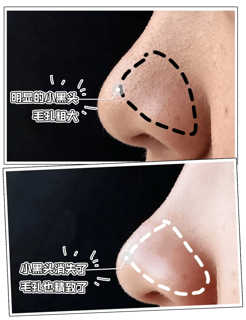 黑下怎么去黑上_黑上黑下是什么意思_下黑上白图片