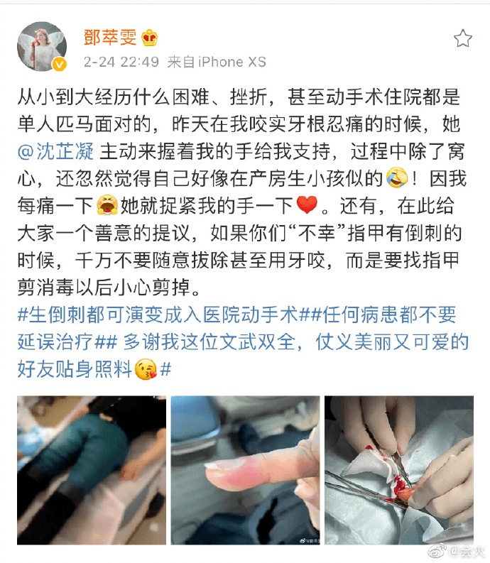 知名女星拔倒钩做手术。医生紧急提醒