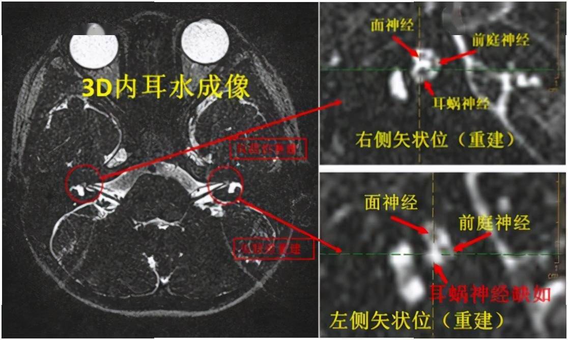 放射科副主任医师李艳梅通过询问患者病史,仔细查看扬扬的磁共振及ct