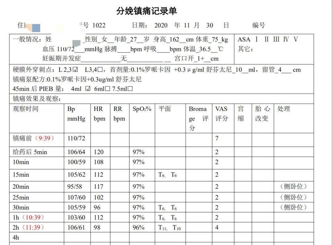 徐醫附院麻醉科一例分娩鎮痛後突發室上速