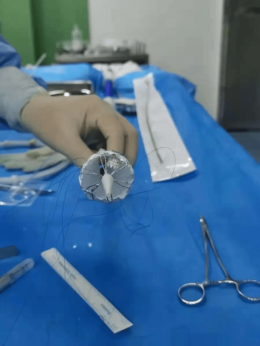 省媒《医药卫生报:孟津县第二人民医院完成主动脉夹层介入手术