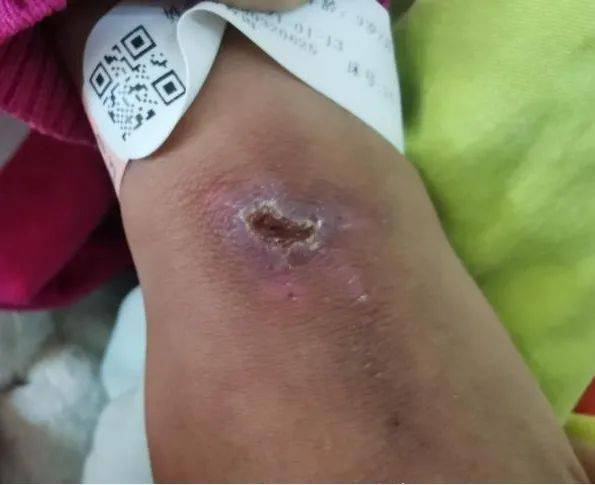 9岁女童反复腹痛只因长期饮用这个东西