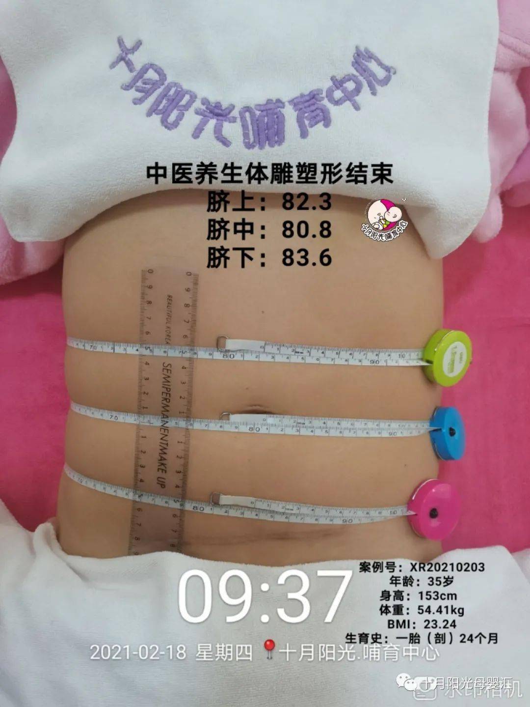 春节变形记 十月阳光 产后体雕案例分享 十八 服务