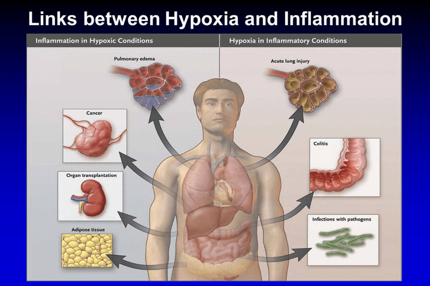 低氧血症与缺氧你分得清吗?_组织