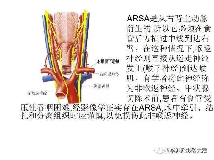 cta詳細解讀頭頸部血管解剖及正常變異