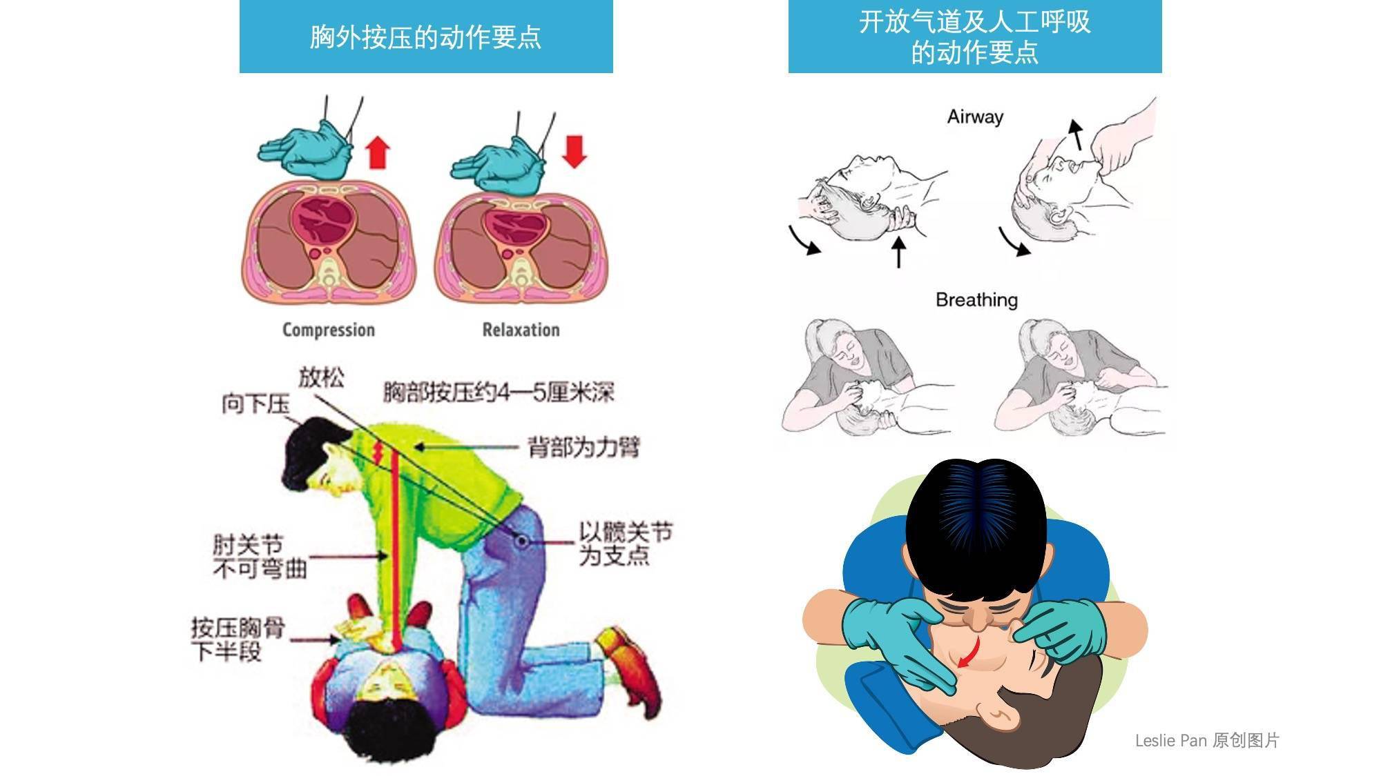 开放气道因为患者平卧时舌根下坠会把气道堵住,所以要采用仰头抬蚍è