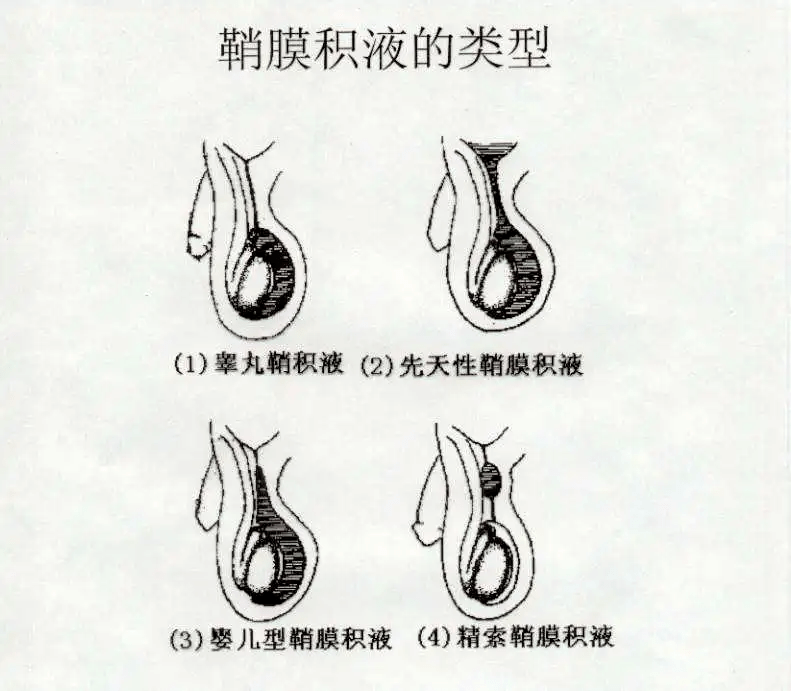 蛋蛋消失了6年才被發現家有男孩這件小事千萬別忽略