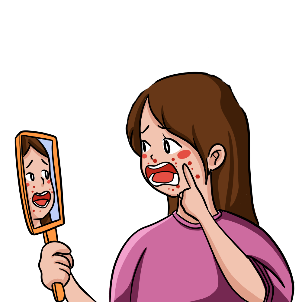 化妆品过敏要报告