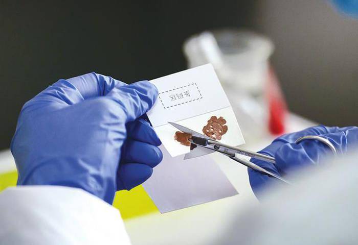 dna鉴定技术助力警方帮多个失散家庭团聚走进实验室揭秘