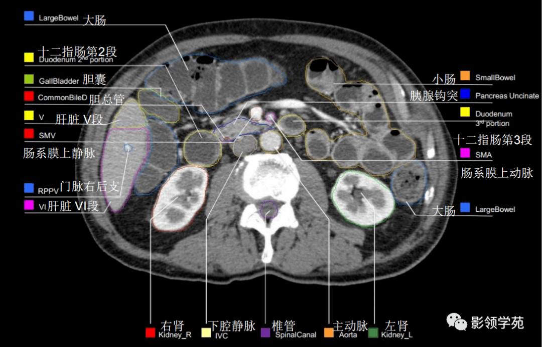 腹部影像学解剖图谱
