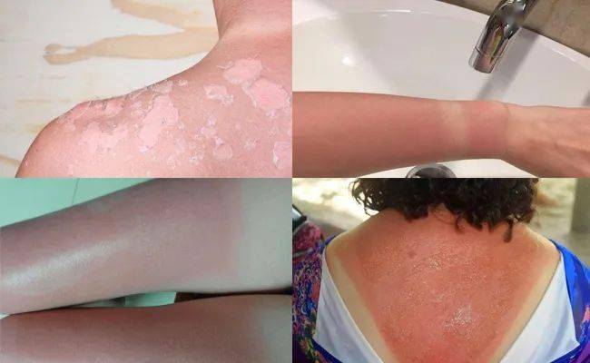 1瓶好的防晒霜清爽养肤又抗老!皮肤好到让人羡慕!