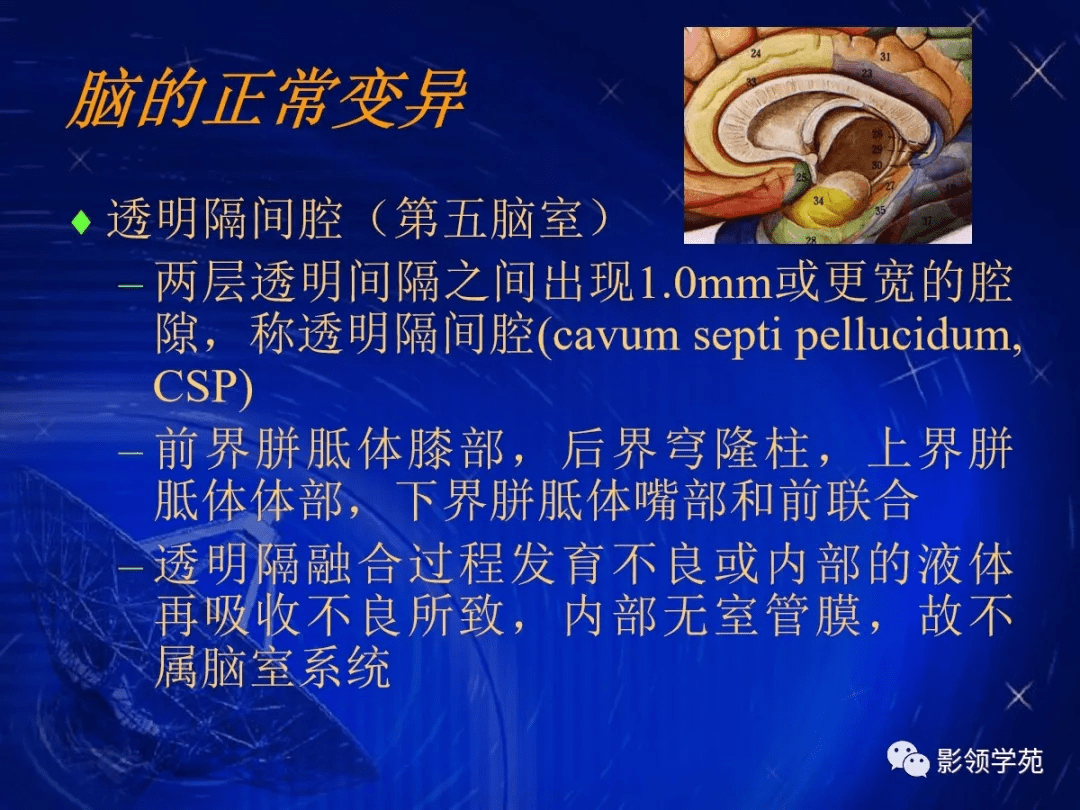 顱腦的影像解剖與常見變異