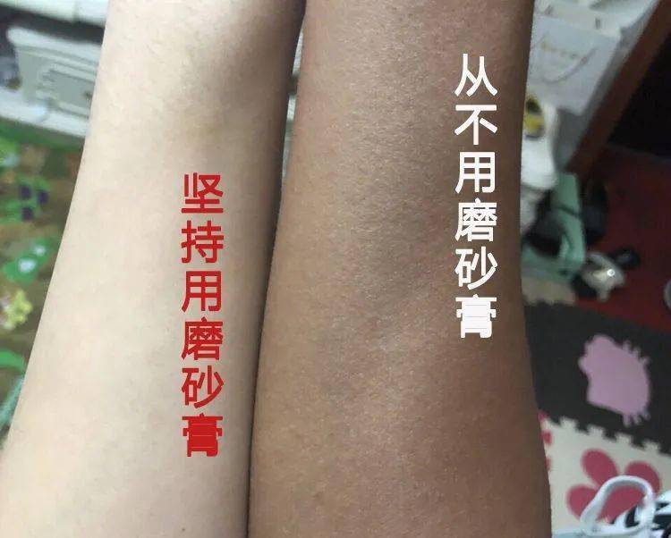 这款磨砂膏能够在分解旧角质的同时非常明显得去除毛孔中的污垢,让