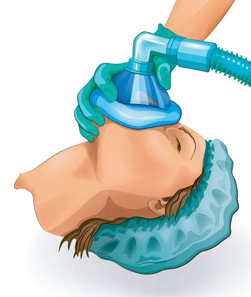 "一闻就倒"的迷药是否真的存在?_麻醉药