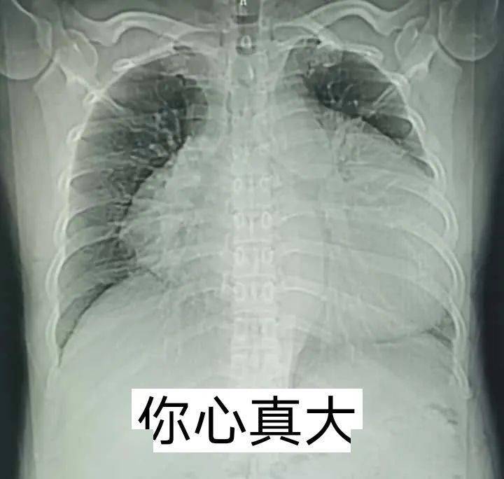 这些表情包居然只有医生才看得懂!