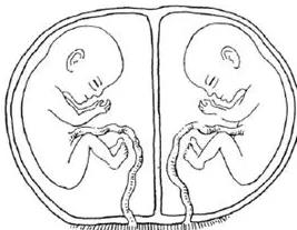 单卵双胎图片