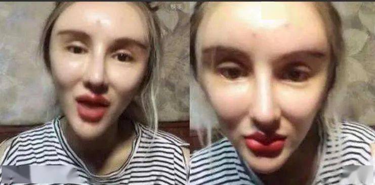 想整容那你得先了解整容对身体的几大危害