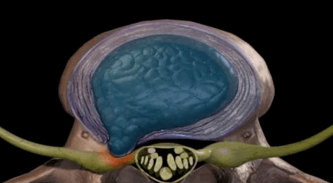 cf2ed9243f8e4b30b9bccf770648bebc.png