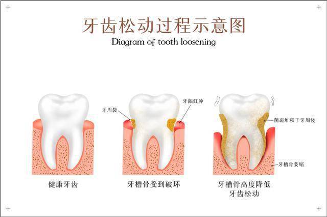 牙线品牌TOP10：发现优质口腔护理的秘密武器