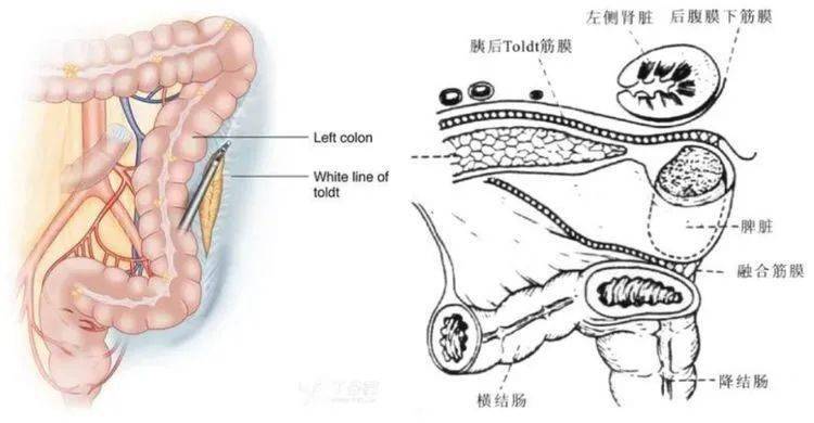 副主任主刀的为时仅53分钟完成的腹腔镜根治性左半结肠切除术惊艳全场