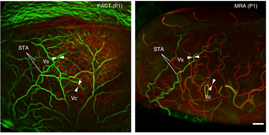 光声成像新突破人脑功能层析成像