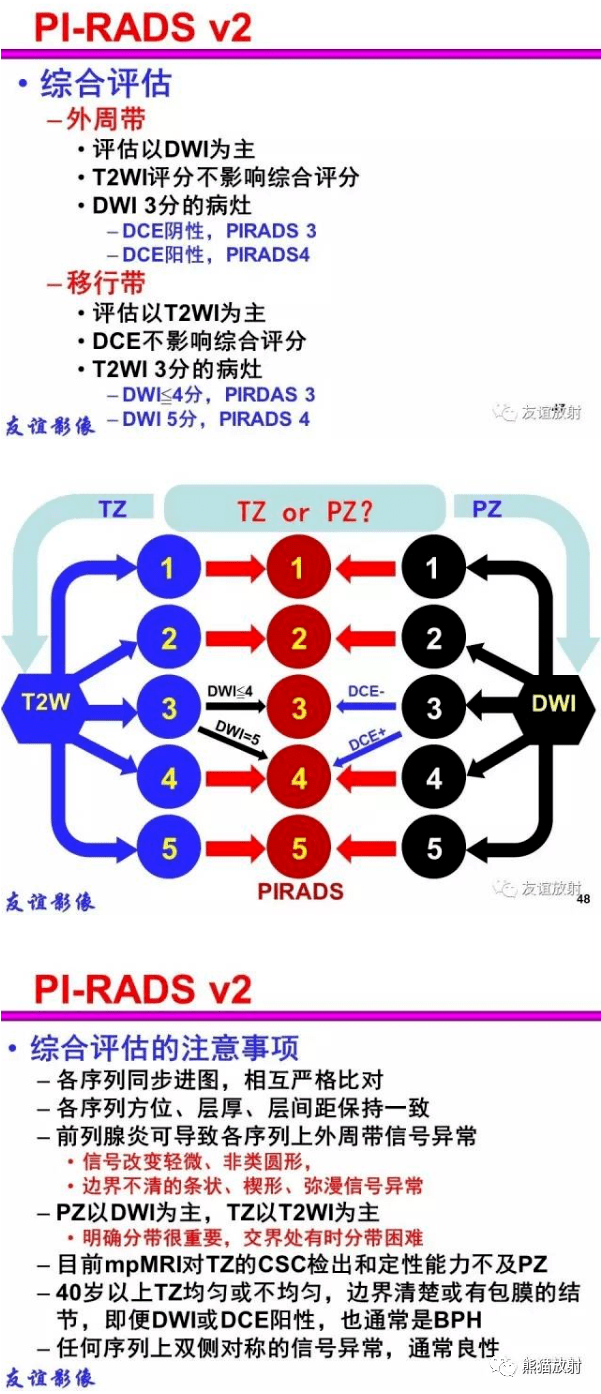 PI-RADS 前列腺影像报告和数据系统_诊断