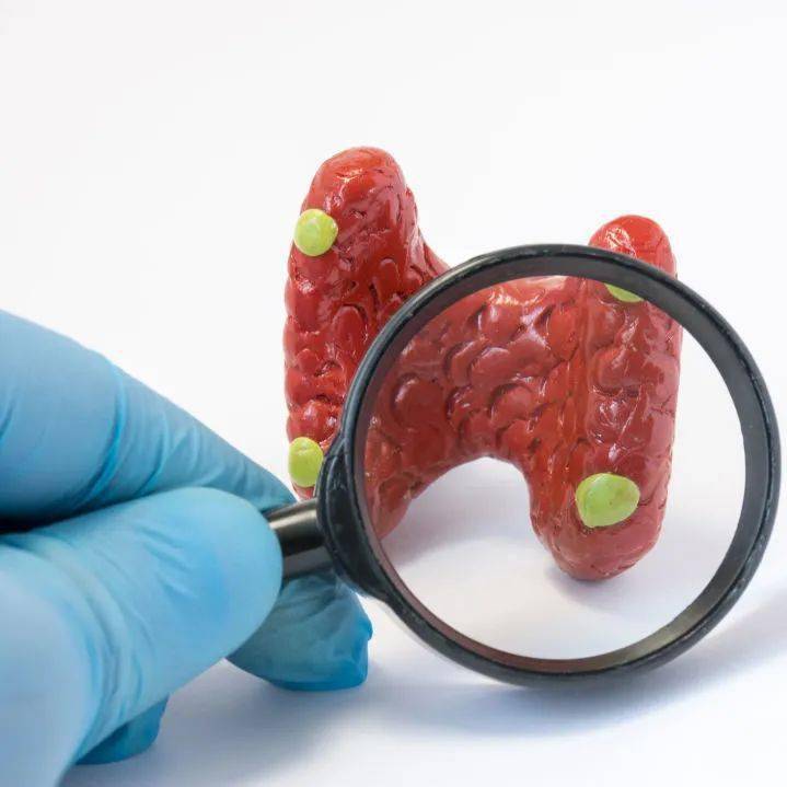 甲状腺肿大,是不是得了桥本甲状腺炎?——中医药防治甲状腺疾病系列科普之三
