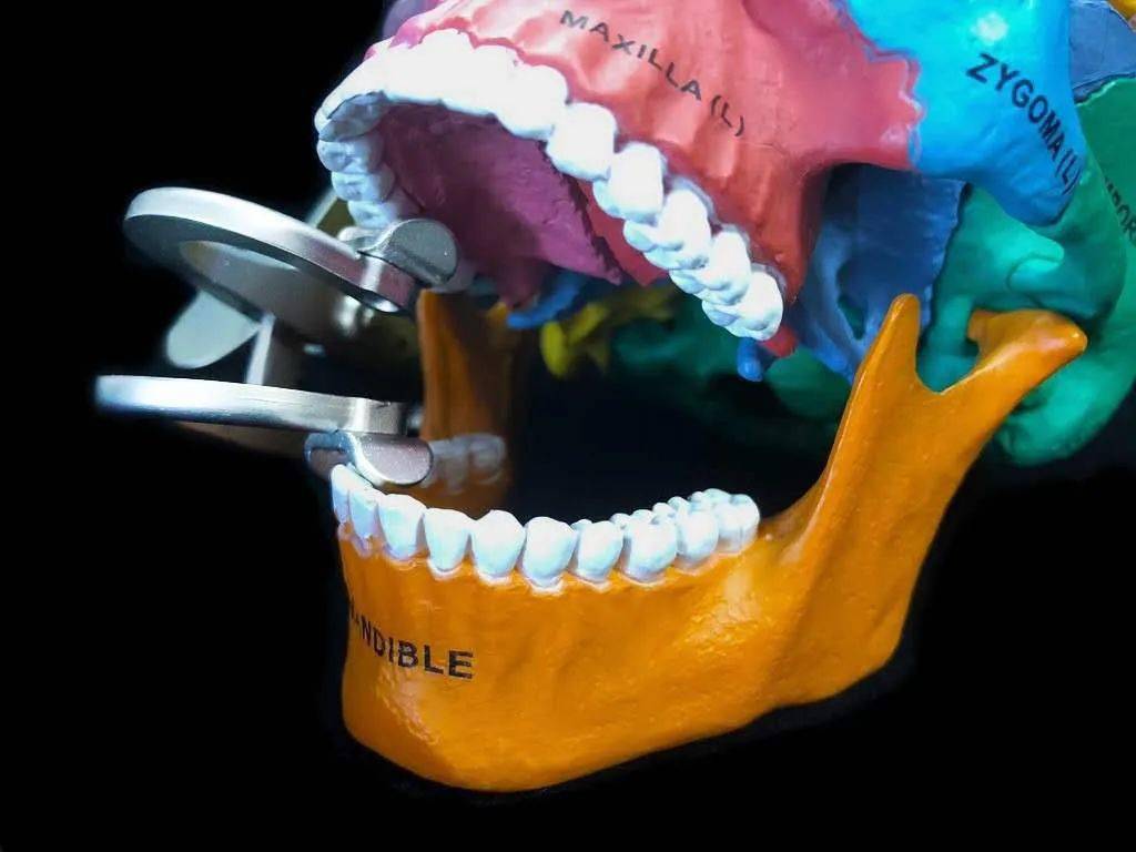 【临床好物】儿牙医生临床利器 | 开口器(儿童开口器)成人可用