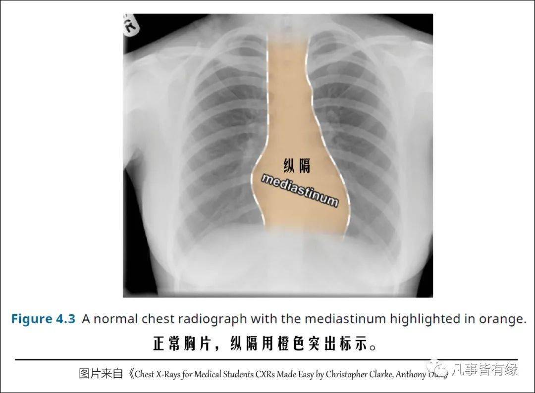 (great vessels),食道(oesophagus),氣管(trachea),膈神經(phrenic